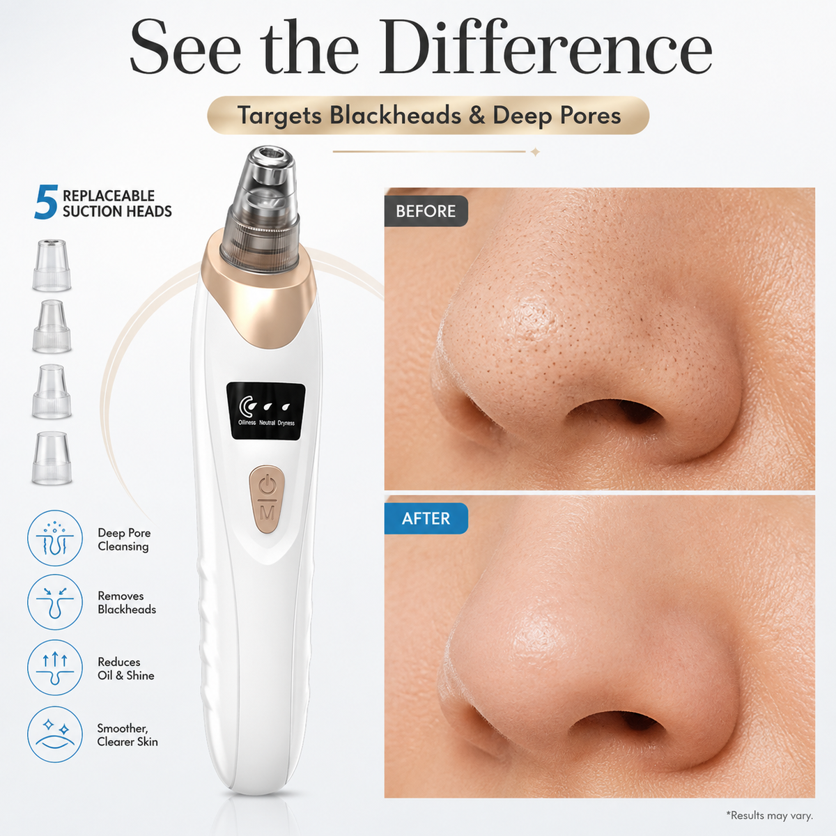 Electric Blackhead Remover Vacuum & Microdermabrasion Facial Cleansing Device – 3 Suction Levels, LED Display & USB Rechargeable